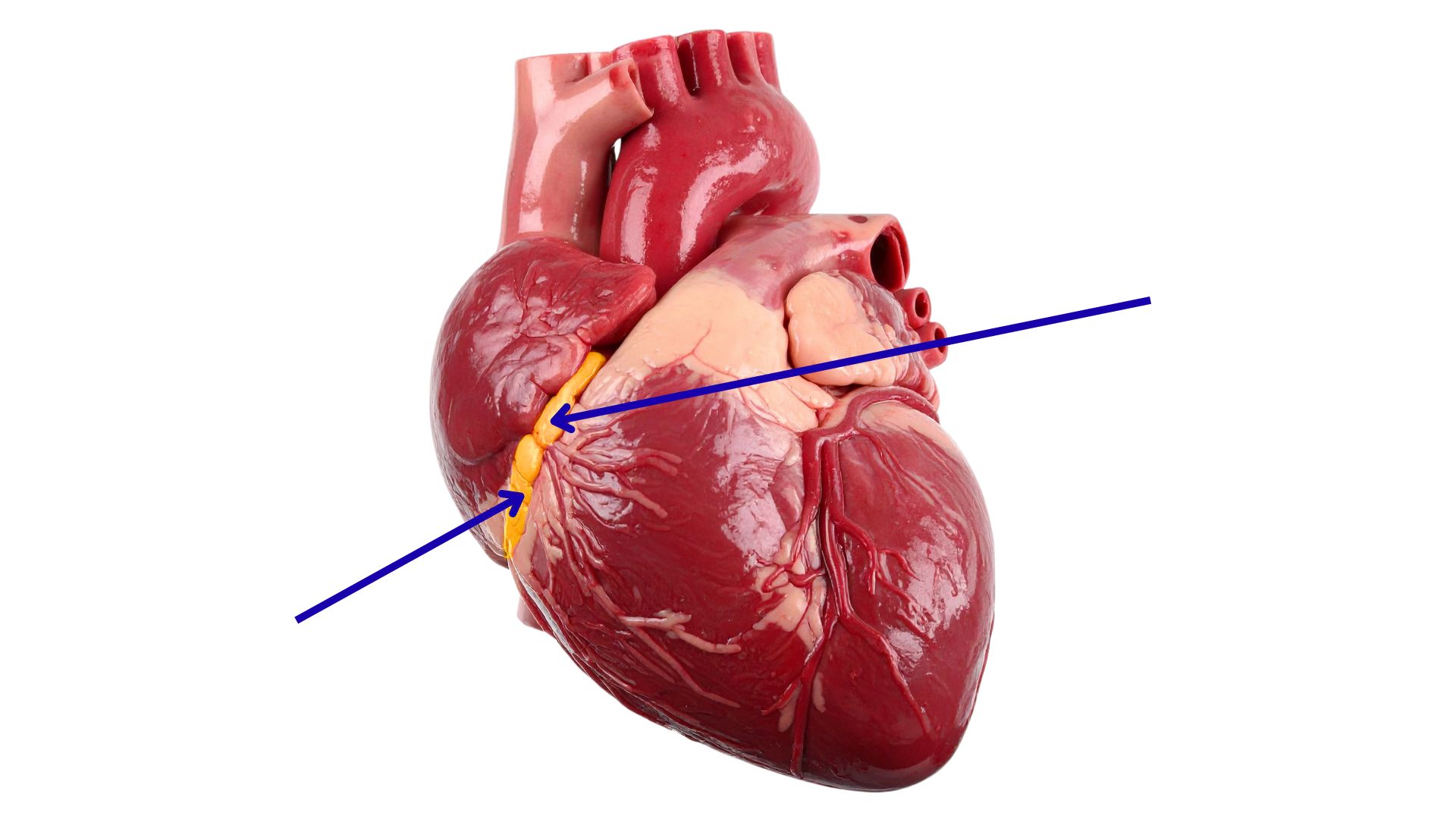 <p><span>What is the highlighted structure on the heart model below?</span></p>