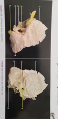 <p>disarticulated</p>