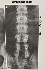 <p>label (a-d) AP lumbar spine</p>