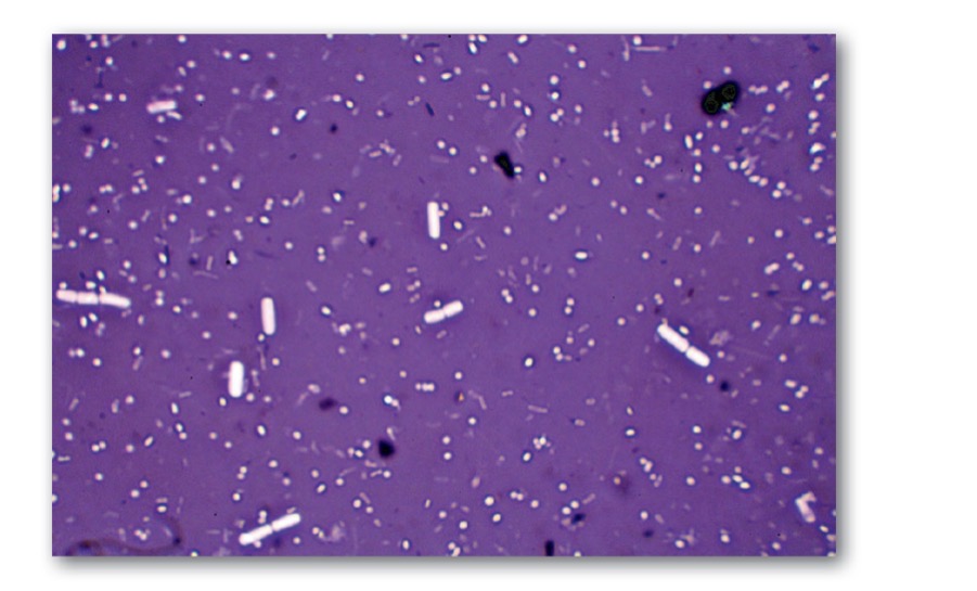 <p>Negative stain</p>