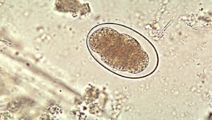 <p><span style="background-color: rgba(0, 0, 0, 0); line-height: 19.7625px;">What is the species in this photo? how do you get infected with it?</span></p>