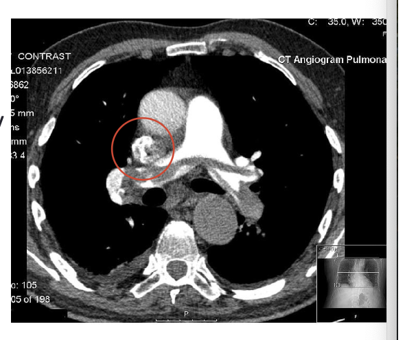 <p>what is depicted in the image? </p>