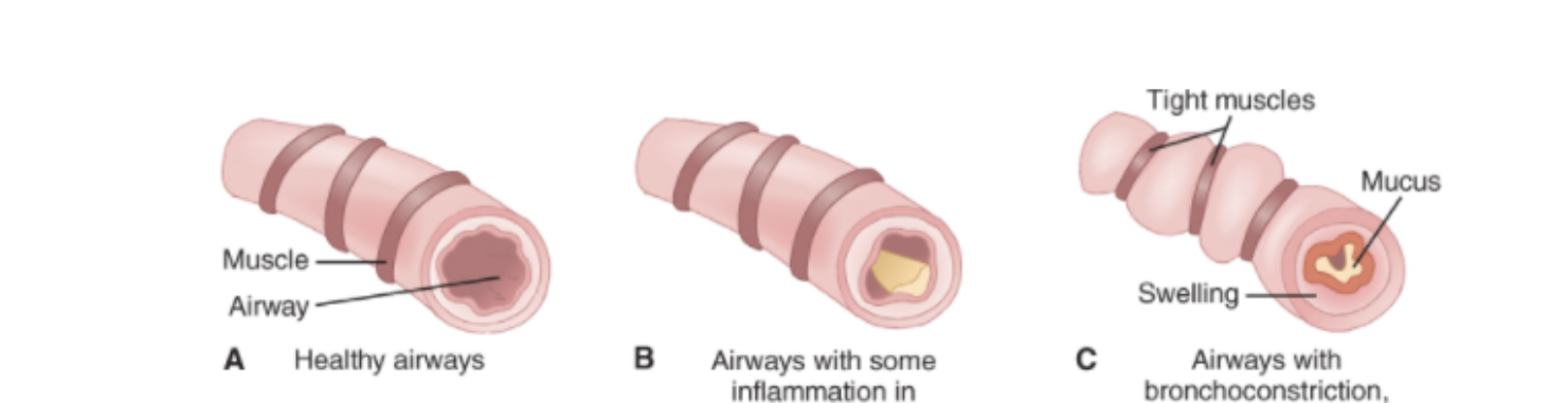 <p>What is this a depiction of? </p>
