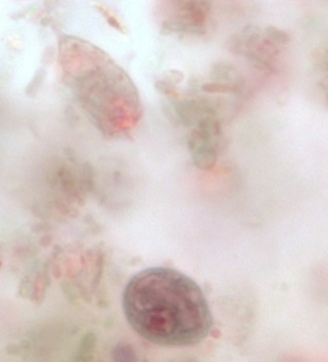 <p>Sherperdās crook</p><p>2 nuclei</p><p>Pear shaped trophozoite</p>