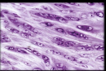 <p>What is the type tissue in this image?</p>