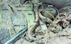 <p>supplies part of the stomach and duodenum</p><p>comes down and splits, goes downward off of the common hepatic artery</p>