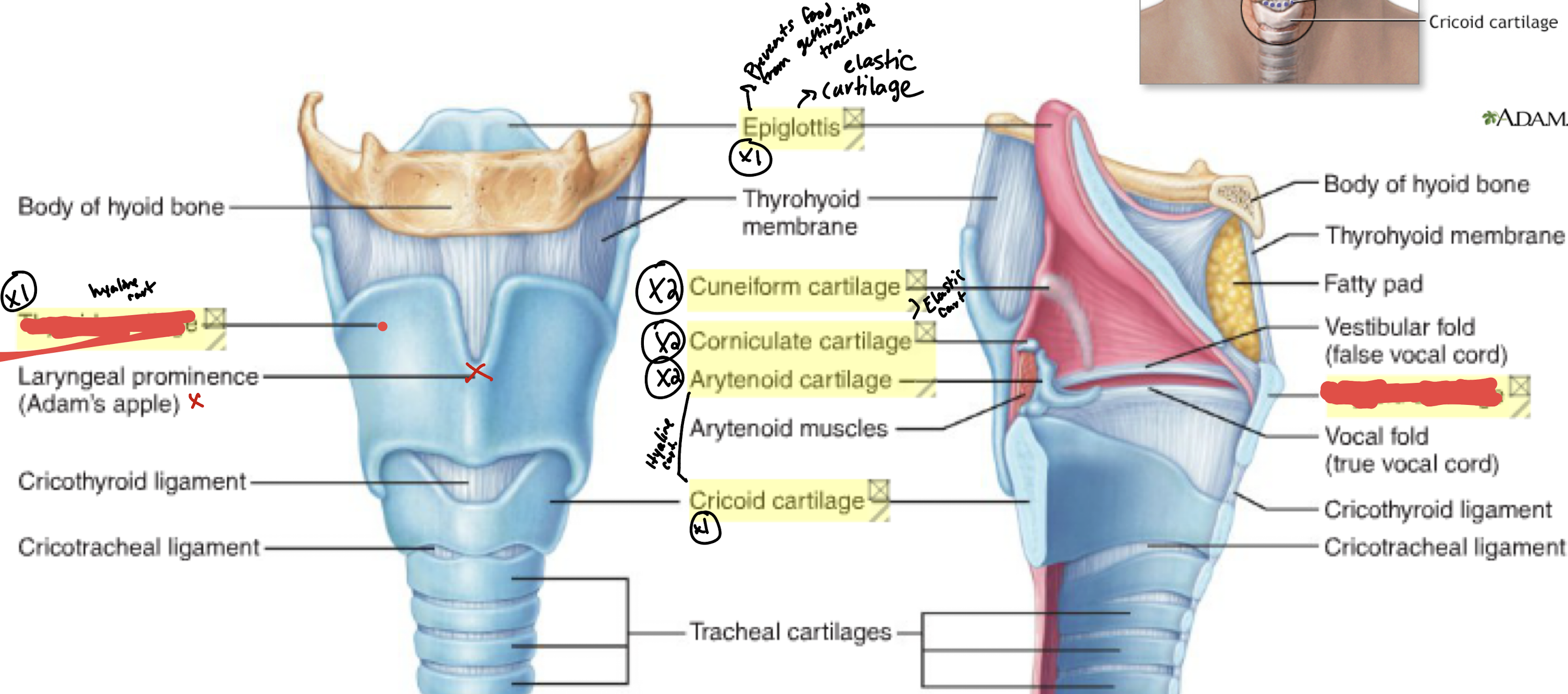 <p>Name this; hyaline cartilage</p>