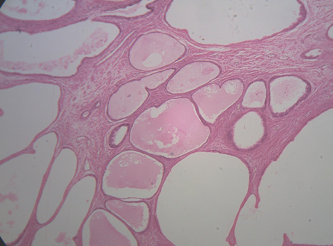 <p>What part of the body is seen in this image?</p>