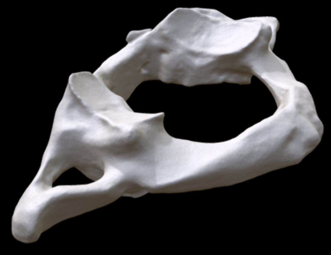 <p><span><strong>Identify the bone the bone shown here.</strong></span></p>
