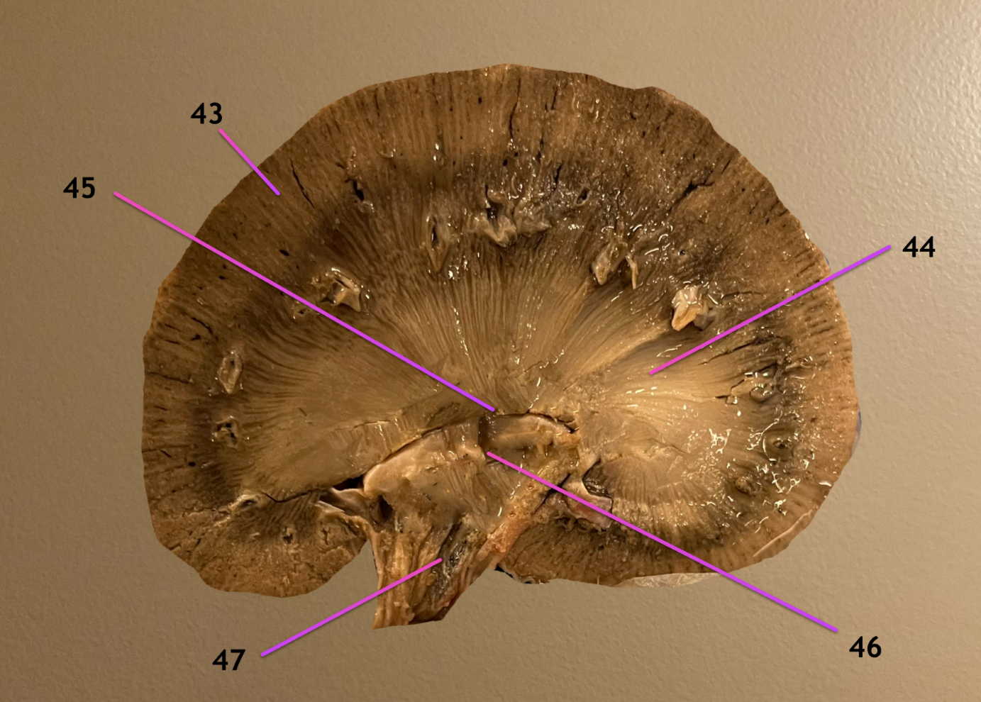 <p>longitudinal section of kidney</p><p>.</p><p>label the topographic region 43, 44</p><p>label 47</p>