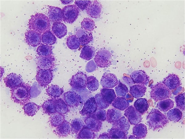 <p>Mast Cell Tumors (FNA Cytology)</p>