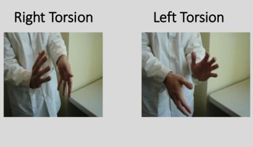 <p>Physiologic, 1 AP axis, sphenoid and occiput will rotate in opposite directions, hands will rotate in opposite directions with one hand rotating up based on the naming of the diagnosis (i.e. right torsion will have right hand rotate superiorly) and the other will rotate down.</p><p></p><p>Extra Info for Comp:</p><p>Named after the direction in which the Greater Wing of Sphenoid will move cephalad/superiorly. </p><p>In a right torsion, sphenoid will rotate left (counterclockwise) around AP axis, bringing its right Greater Wing superiorly. </p><p>In a left torsion, sphenoid will rotate right (clockwise) around AP axis, bringing its left Greater Wing superiorly. </p>