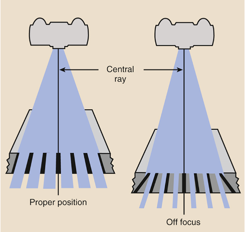 <p>Grid cutoff more severe at edges. Symmetrical grid cutoff, loss of exposure toward lateral edges of image</p>