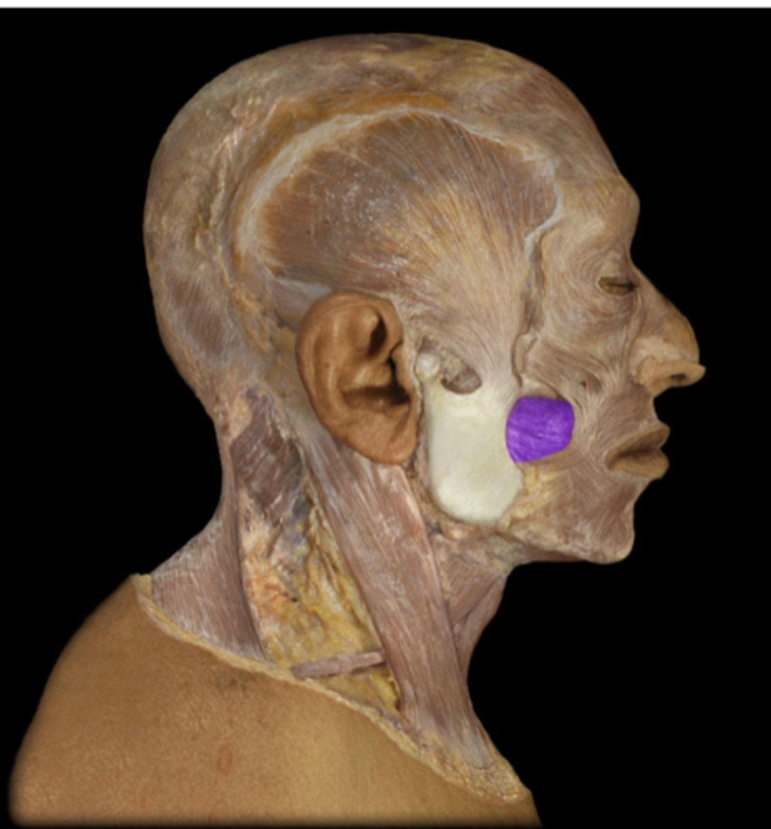 <p>What muscle is indicated in purple?.,.,</p>