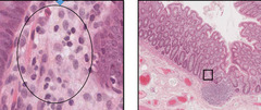<p>Identify the connective tissue in the circled location?</p>