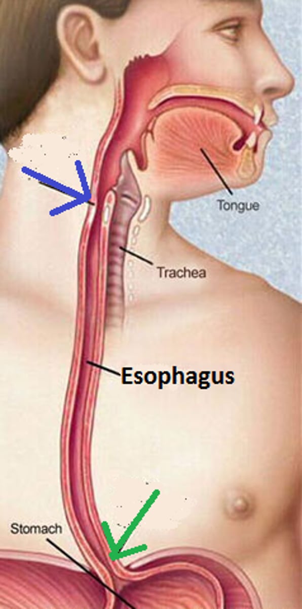<p>esophageal</p>