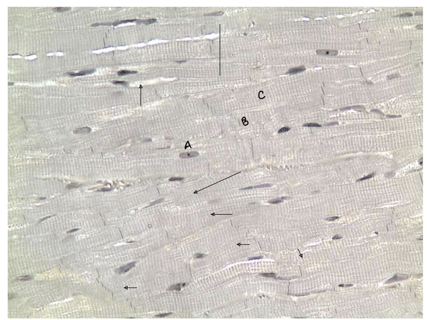 <p>What kind of muscle tissue is this? Label + function. Where is it found in the body?</p>