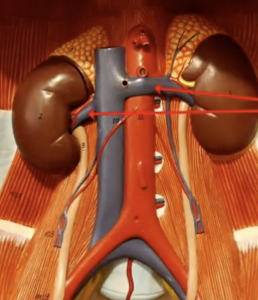 <p>What are the arrows pointing to?</p>