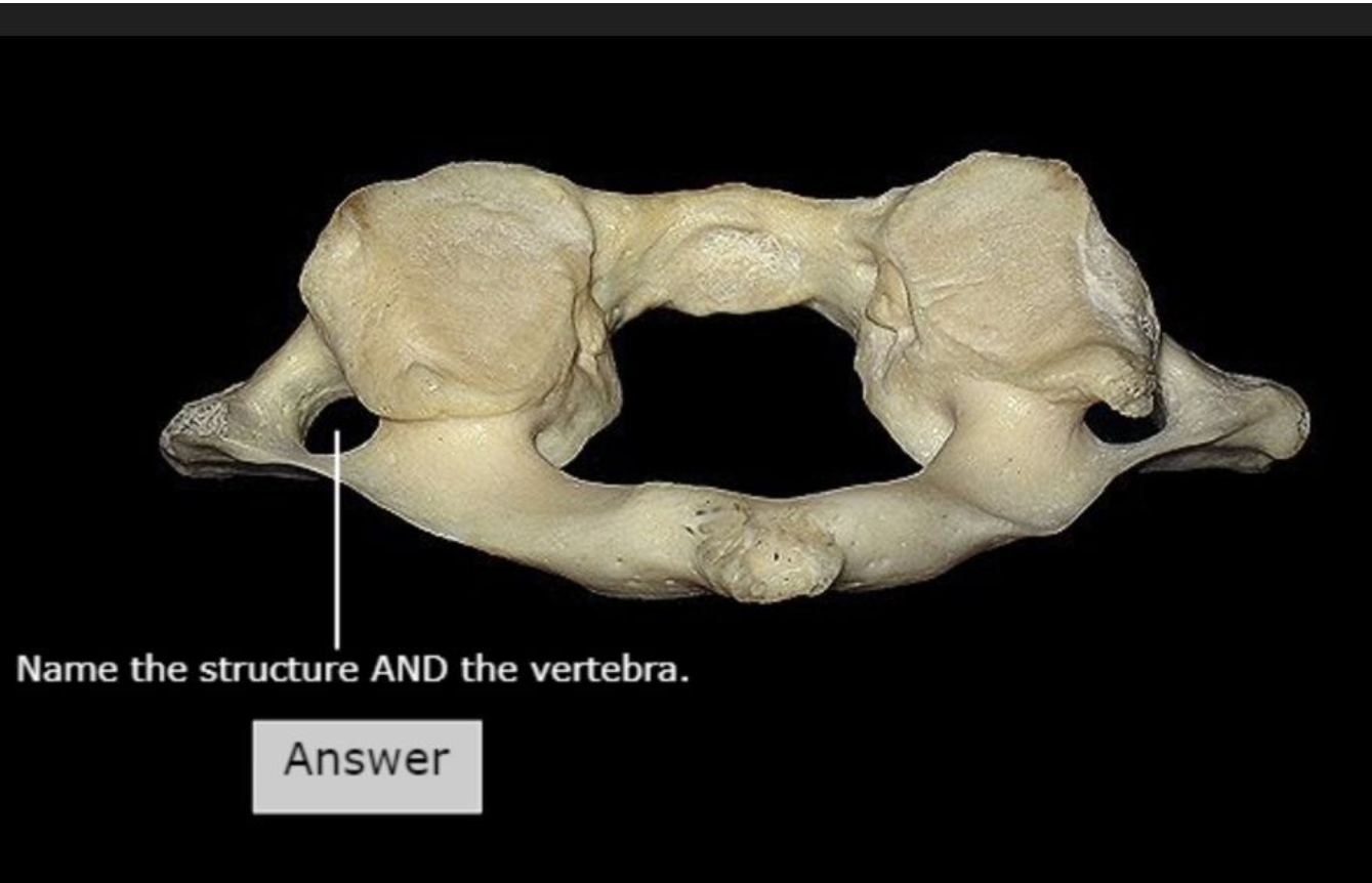 <p>Just name the structure</p>