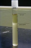 <p>Based on the growth pattern within the tube, what type of anaerobic tolerance is this microorganism?</p>