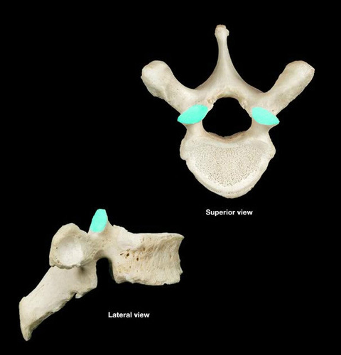 <p>A flat or nearly flat surface on a bone; where two vertebrae articulate; inferior side</p>