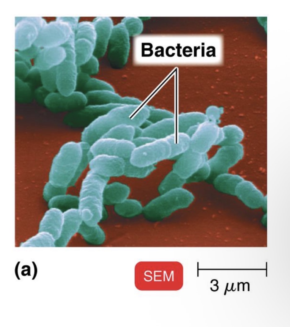 <p>bacteria</p>