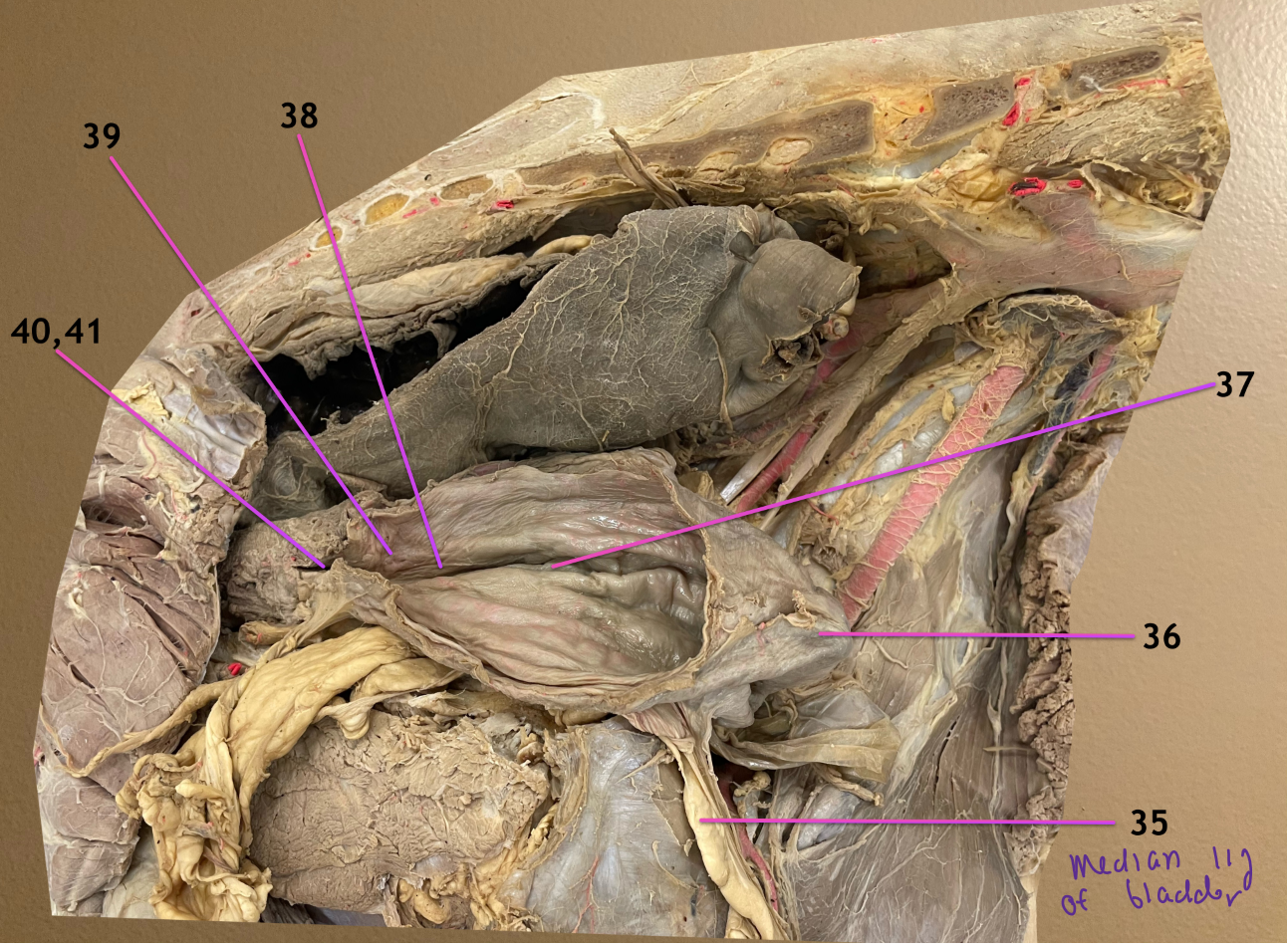 <p>UB is opened, cranial to rt</p><p>.</p><p>label the topographic regions of the UB: 36-39</p><p>.</p><p>label 40 &amp; its opening 41</p>