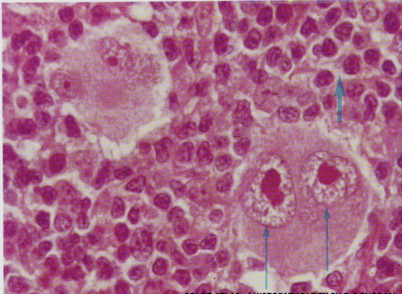 term image
