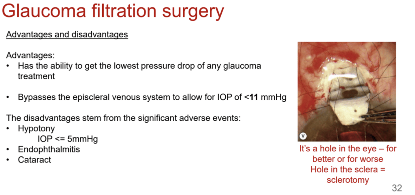 <p>What are the disadvantages of glaucoma filtration surgery?</p>