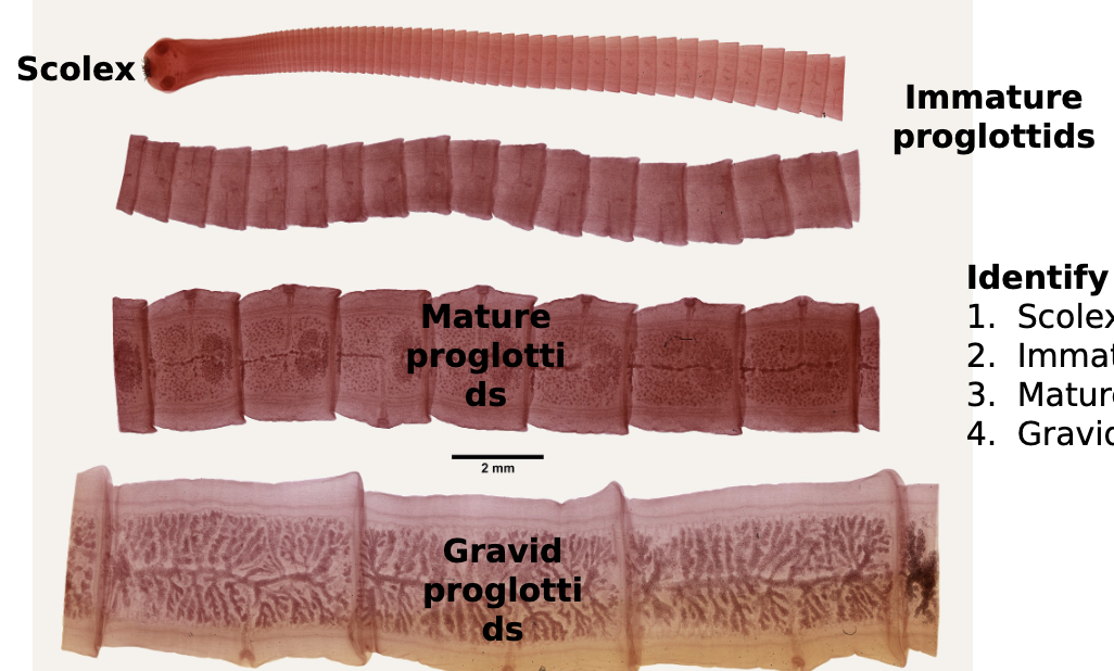 <p>cestoda (tape worms)</p>