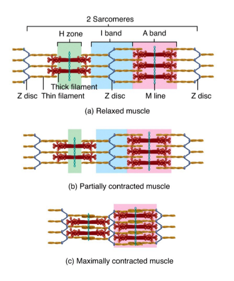 <ul><li><p>myocyte contraction → myosin heads of thick myofilaments bind thin myofilament </p></li><li><p>myosin heads pull thin myofilaments toward M line (sarcomere center)</p></li><li><p><span data-name="arrow_up" data-type="emoji">⬆</span>overlap = <span data-name="arrow_down" data-type="emoji">⬇</span> sarcomere length (shortens)</p><ul><li><p>all sarcomeres of all myofibrils shorten at same time = entire myocyte shortens</p></li></ul></li></ul><p></p>