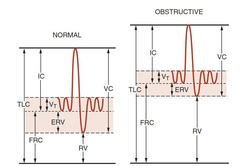 <p>A test used to assess lung function by measuring the volume of air inhaled and exhaled</p>