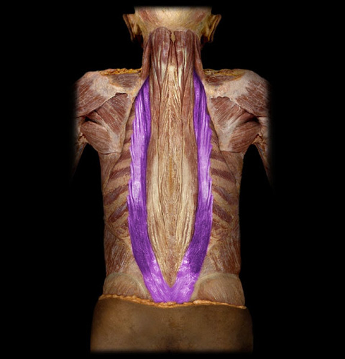 <p>Errector Spinae</p>