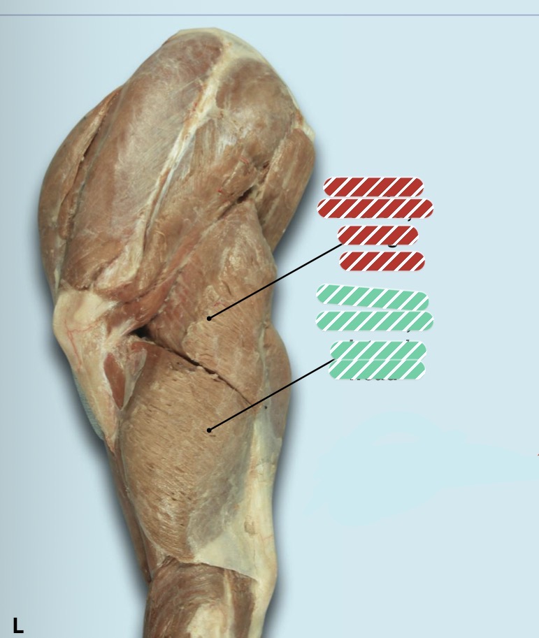 <p>Identify the muscle in green </p>