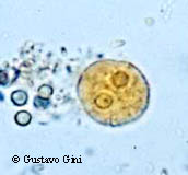 <p>10-20um, Round, <u>cigar shaped chromatoidal bars</u>. 1, 2, or 4 nuclei. Small central karyosome. Even PC</p>