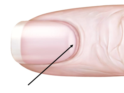 <p>The arrow in the diagram in pointing towards the</p>