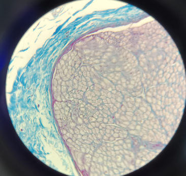 <p>Peripheral Nerve - Azan</p><ul><li><p><strong>Focus:</strong> Used specifically to identify <strong>non-myelinated neurons</strong>.</p></li><li><p><strong>Visuals:</strong> Axons appear as <strong>red dots</strong> with a <strong>blue outline</strong> called the <strong>endoneurium</strong>.</p></li><li><p><strong>Layers:</strong> Includes <strong>perineurium</strong> (red line) and <strong>epineurium</strong> (outermost loose connective tissue)</p></li></ul><p></p>