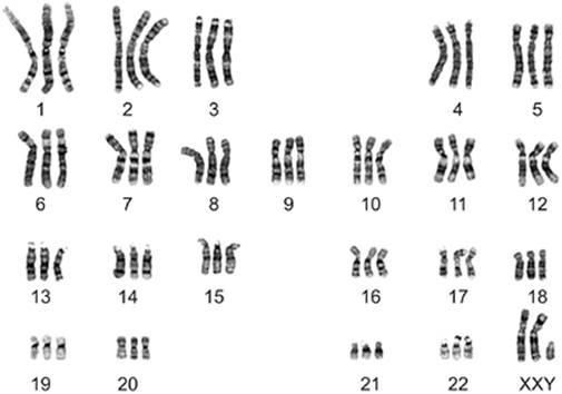 <p>extra sets of chromosomes</p>