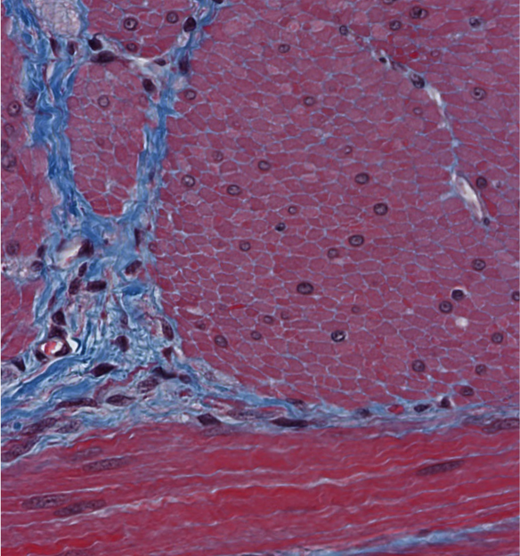 <p><span style="font-family: "Calibri Light";">Are these myocyte nuclei centrally or peripherally located?</span></p>