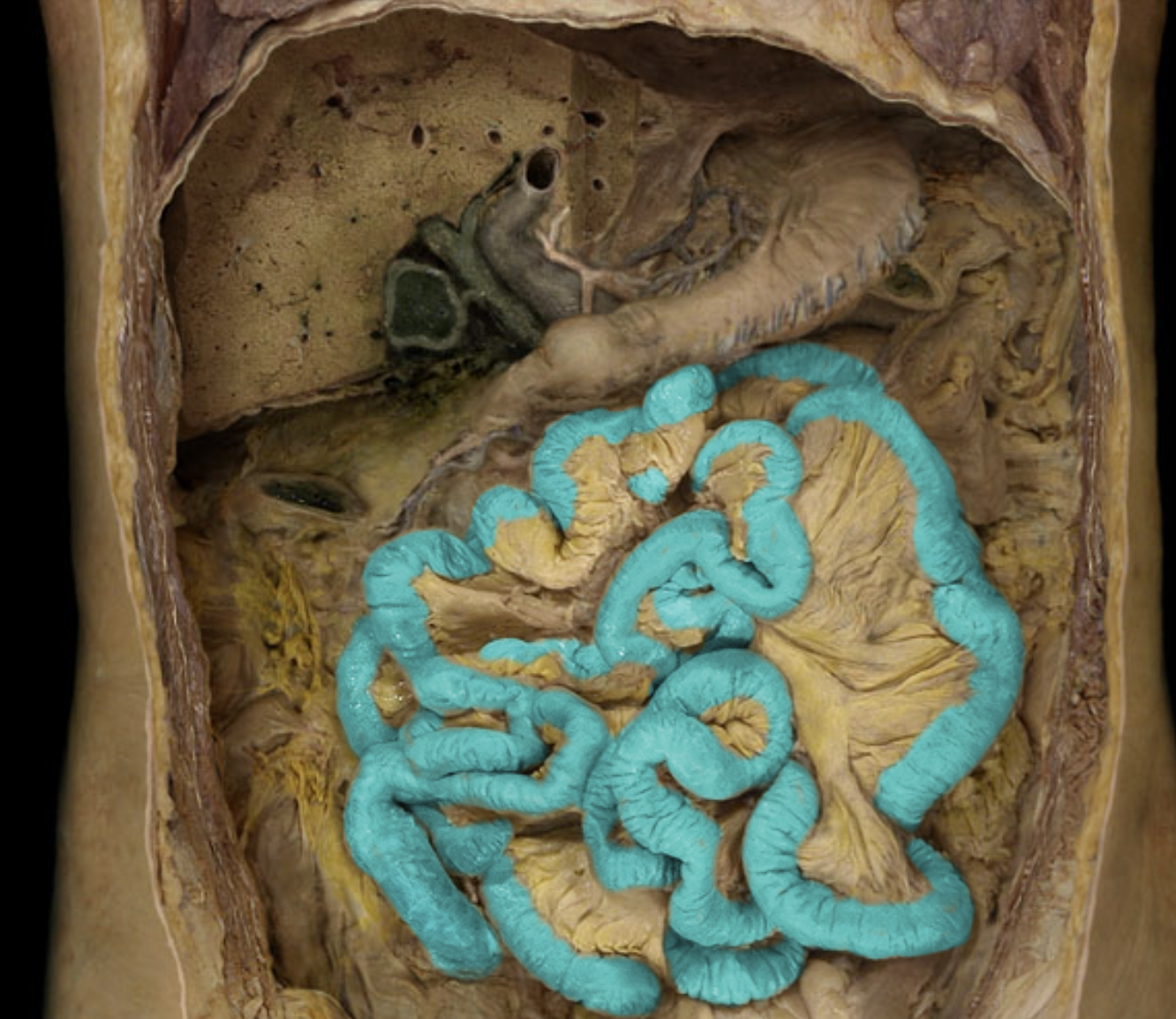 term image