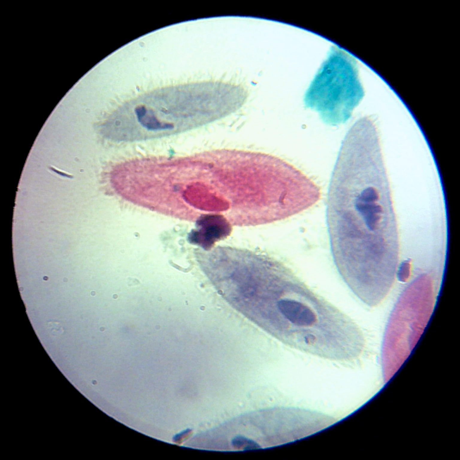 <p>What cell slide is this, and is it a prokaryote?</p>