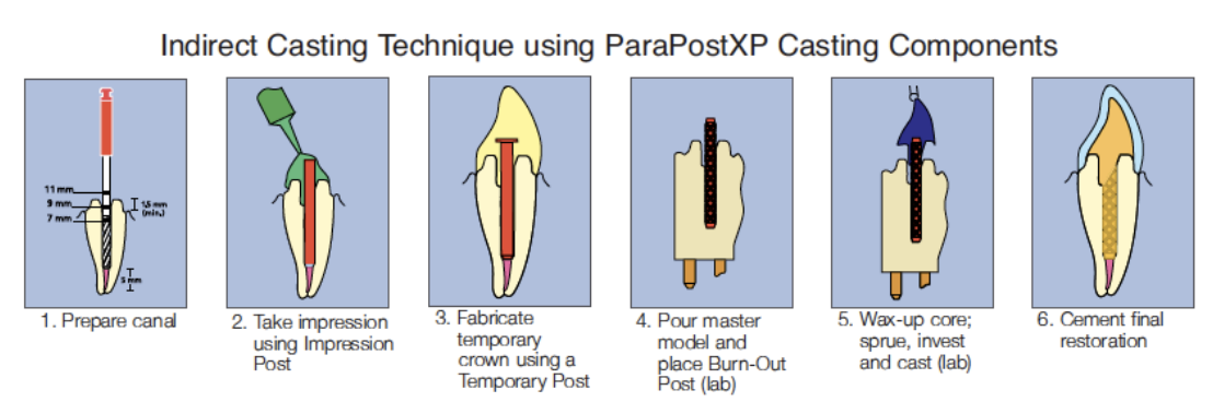 <ol><li><p>prepare canal </p></li><li><p>place impression post and take impression → post will be in impression</p></li><li><p>fabricate temp crown using a temp post </p></li><li><p>lab will take impression to: </p><ol><li><p>pour master model and place burn-out post </p></li><li><p>wax-up core, sprue, invest and cast </p></li></ol></li><li><p>cement final restoration </p></li></ol><p></p>