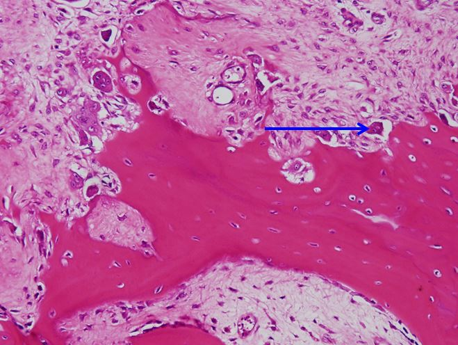 <p>Tế bào gì ?</p>