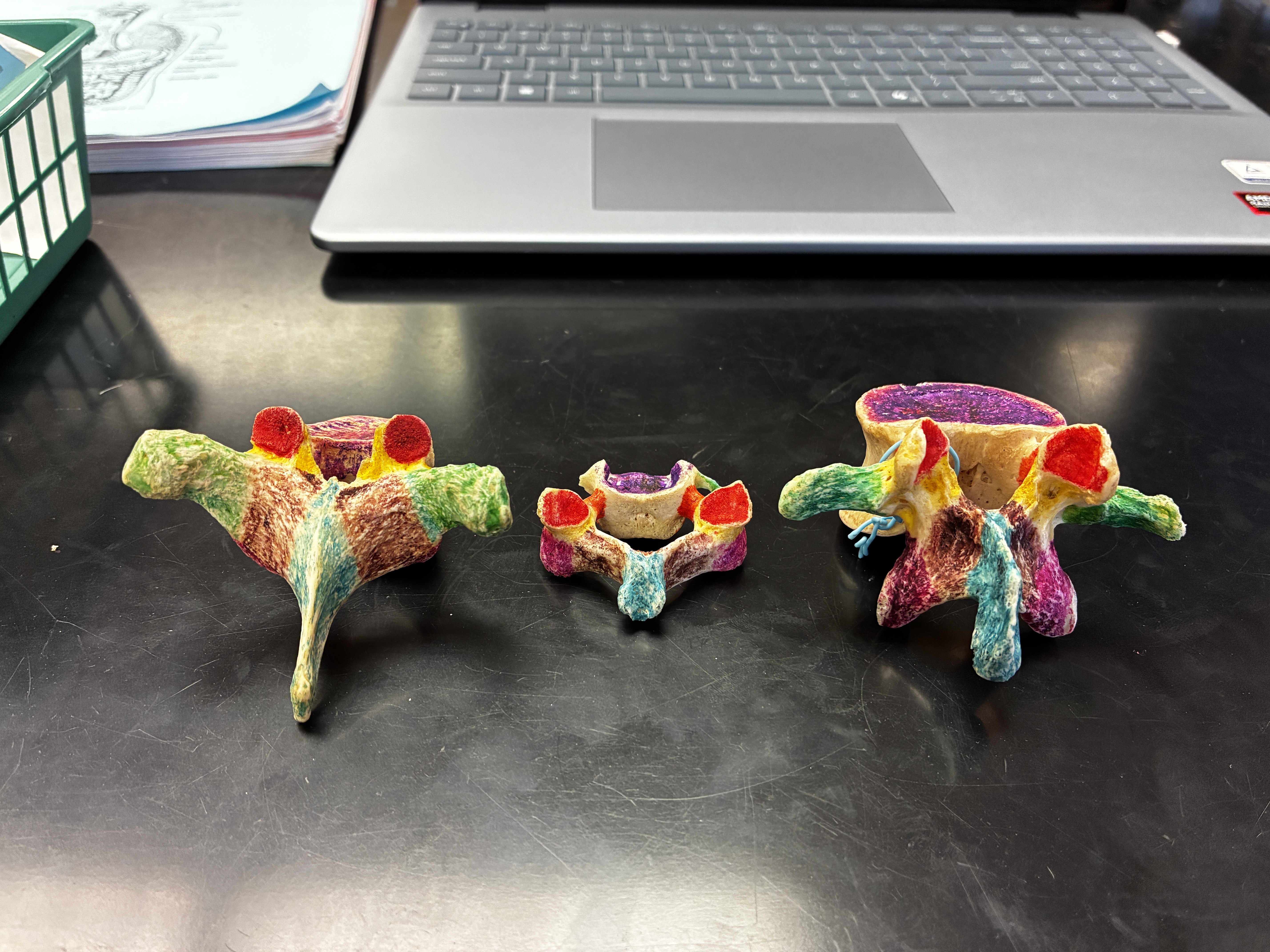 <p>What’s the name of the Red parts of the model?</p>