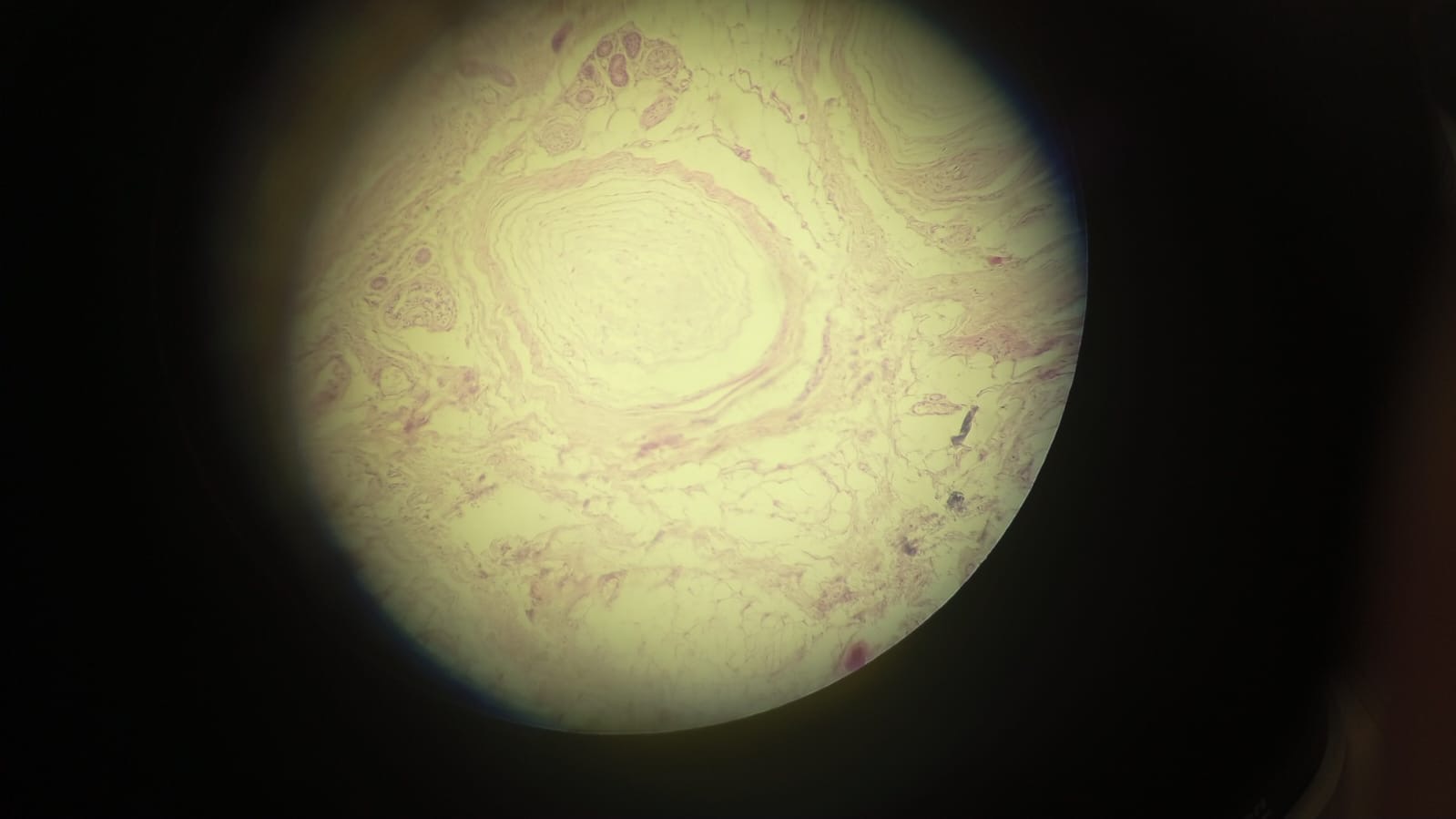 term image