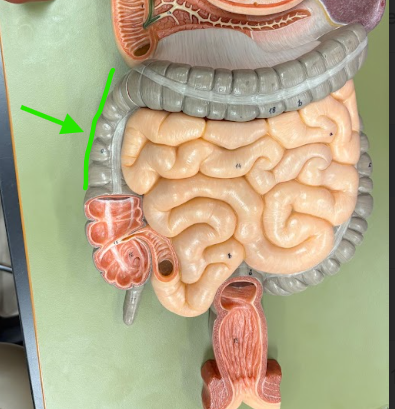 <p>What is the arrow pointing at?</p>