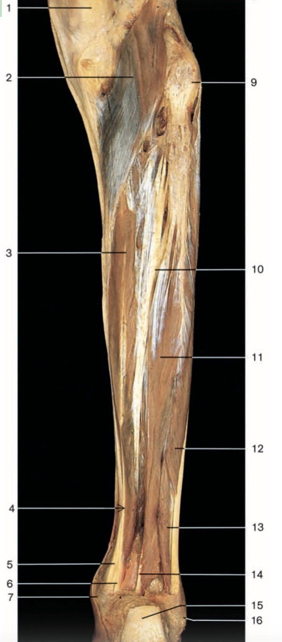 <p>Pinche 3</p>