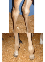 <p>neonatal septic arthritis</p>