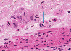 <p>Name the cell to which this nucleus belongs.</p>