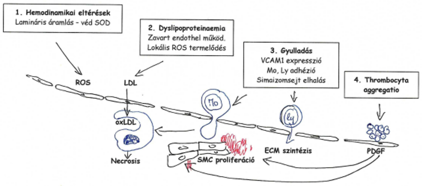 <p>Válasz a károsodásra<br>Hemodinamikai eltérések<br>Dyslipoproteinaemia<br>Gyulladás<br>Thrombocyta aggregáció</p><p>Klonáris elmélet</p>